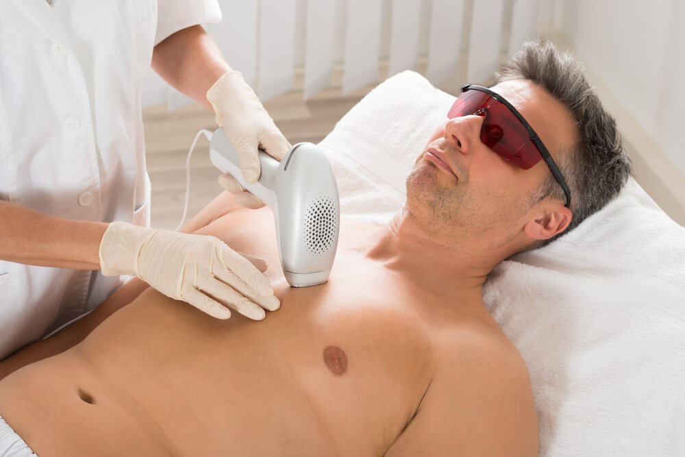 Laser Hair Removal